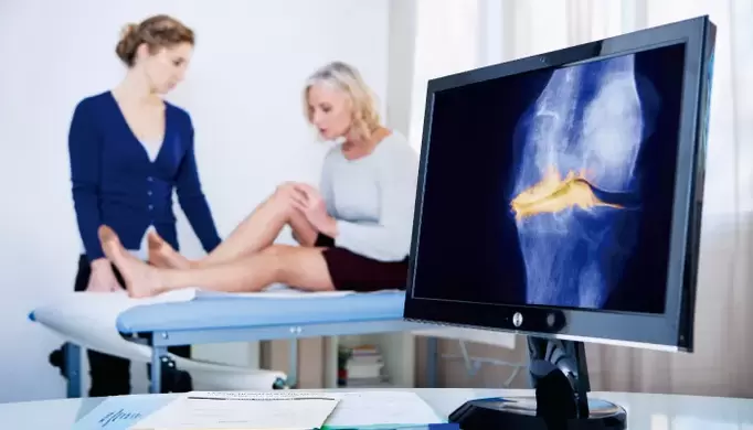 artrose da articulación nunha muller